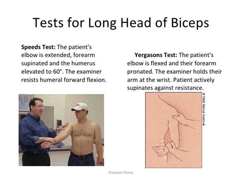 biceps long head tear test|biceps tendonitis test results.